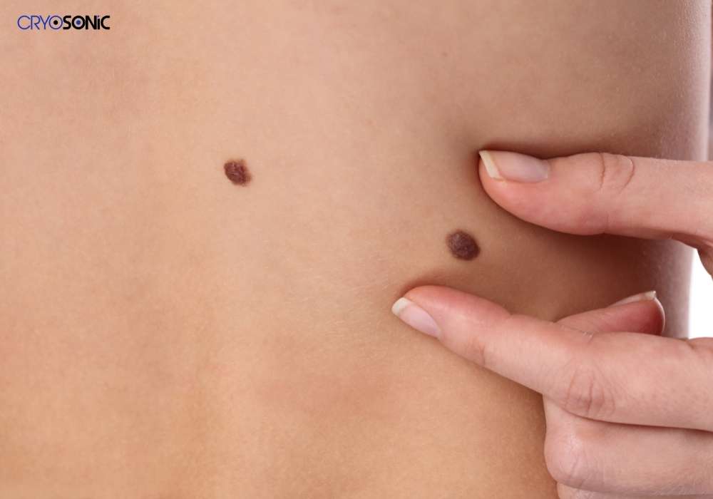 Infection Risk and Poor Aftercare Guildford