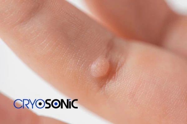 Contact Cryosonic today to learn more about us Guildford now! Guildford