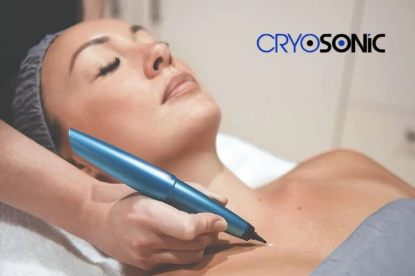 Cryosonic lesion removal prices book today! Guildford