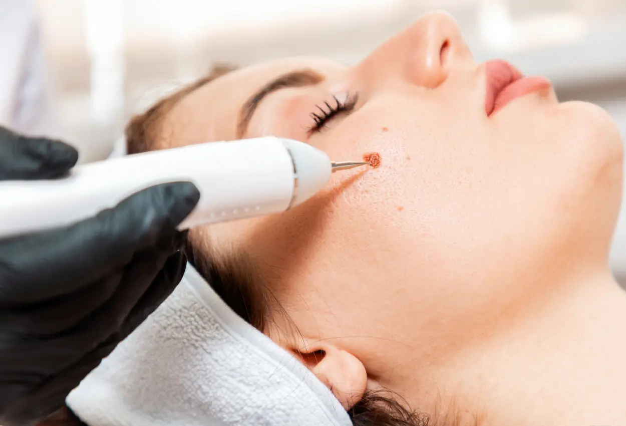 Frequently Asked Questions About Multiple Cryotherapy Treatments Guildford