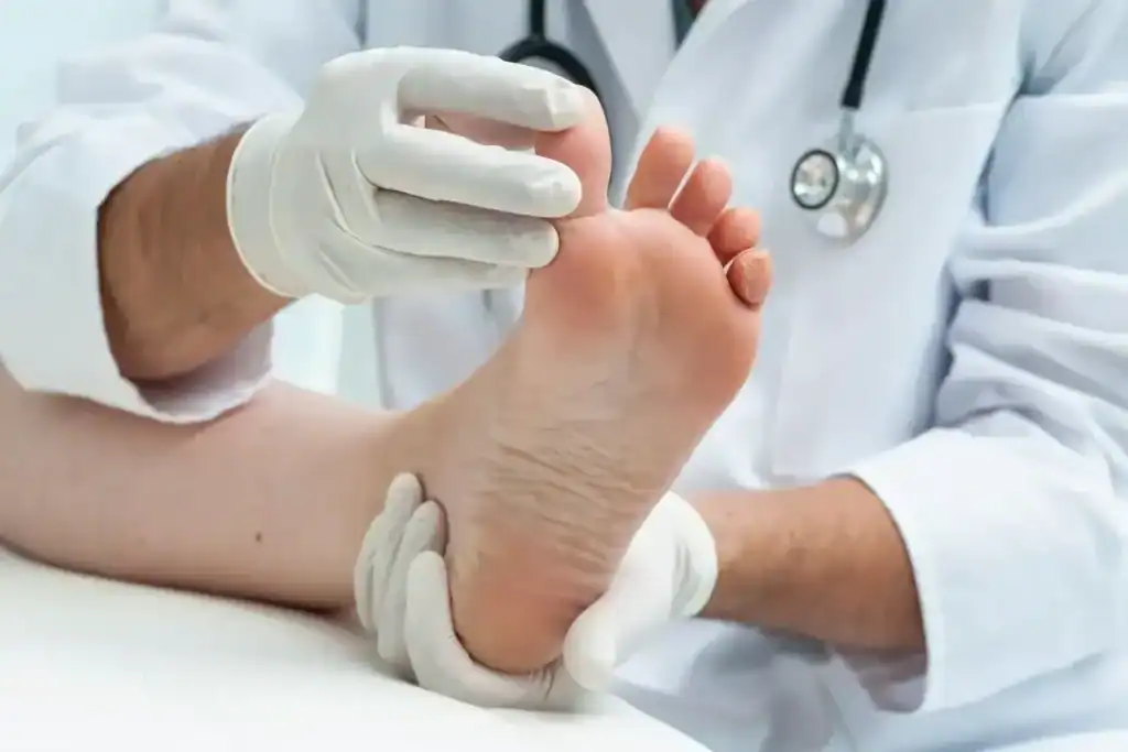 Porokeratosis Removal Treatment Guildford